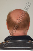  Street  831 bald hair head 0001.jpg